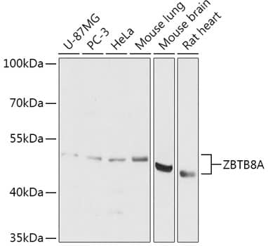 Western Blot: ZBTB8A Antibody [NBP3-35798] - Western blot analysis of various lysates using ZBTB8A Rabbit pAb at 1:1000 dilution.Secondary antibody: HRP-conjugated Goat anti-Rabbit IgG (H+L) at 1:10000 dilution.Lysates/proteins: 25ug per lane.Blocking buffer: 3% nonfat dry milk in TBST.Detection: ECL Basic Kit.Exposure time: 10s.