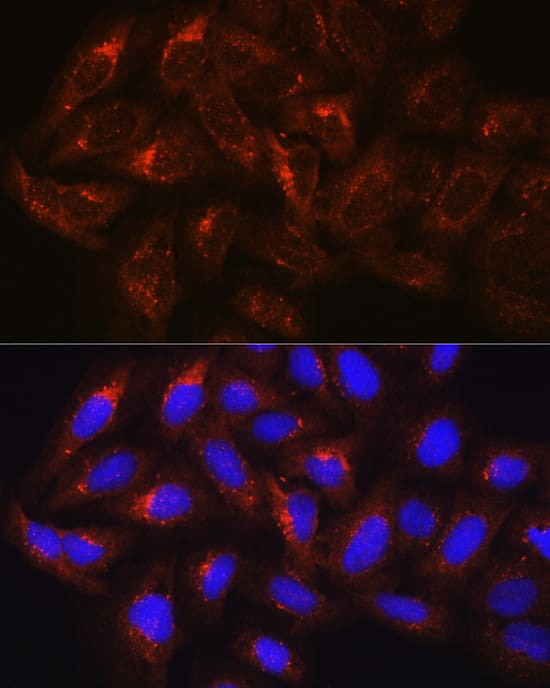 Immunocytochemistry/ Immunofluorescence: HGS Antibody [NBP3-35799] - Immunofluorescence analysis of U-2 OS cells using HGS Rabbit pAb at dilution of 100 (40x lens). Secondary antibody: Cy3-conjugated Goat anti-Rabbit IgG (H+L) at 1:500 dilution. Blue: DAPI for nuclear staining.