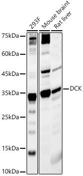 Western Blot: DCK Antibody [NBP3-35800] - Western blot analysis of various lysates, using DCK Rabbit pAb at 1:2000 dilution.Secondary antibody: HRP-conjugated Goat anti-Rabbit IgG (H+L) at 1:10000 dilution.Lysates/proteins: 25ug per lane.Blocking buffer: 3% nonfat dry milk in TBST.Detection: ECL Basic Kit.Exposure time: 60s.