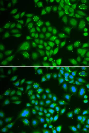 Immunocytochemistry/ Immunofluorescence: DCK Antibody [NBP3-35800] - Immunofluorescence analysis of HeLa cells using DCK Rabbit pAb. Secondary antibody: Cy3-conjugated Goat anti-Rabbit IgG (H+L) at 1:500 dilution. Blue: DAPI for nuclear staining.