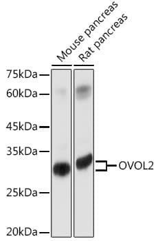 Western Blot: OVOL2 Antibody [NBP3-35802] - Western blot analysis of various lysates using OVOL2 Rabbit pAb at 1:1000 dilution.Secondary antibody: HRP-conjugated Goat anti-Rabbit IgG (H+L) at 1:10000 dilution.Lysates/proteins: 25ug per lane.Blocking buffer: 3% nonfat dry milk in TBST.Detection: ECL Basic Kit.Exposure time: 1s.