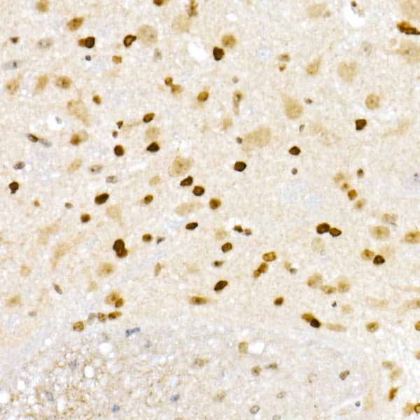 Immunohistochemistry XRCC2 Antibody