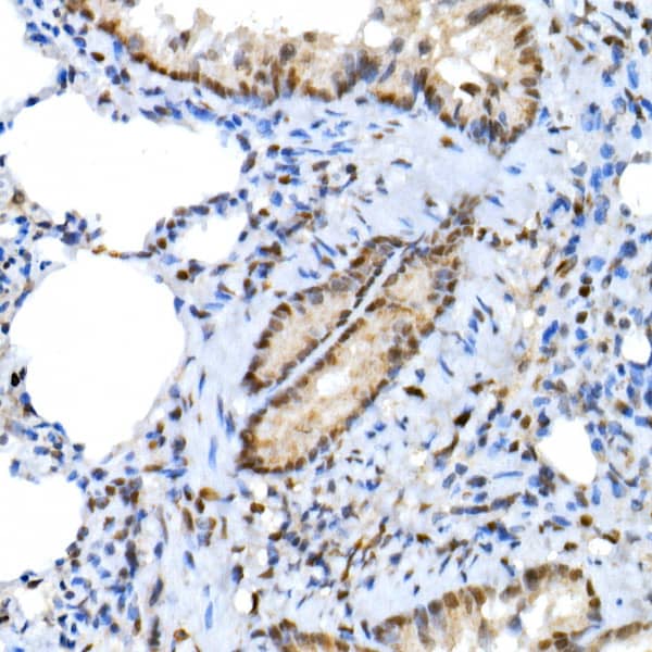 Immunohistochemistry XRCC2 Antibody