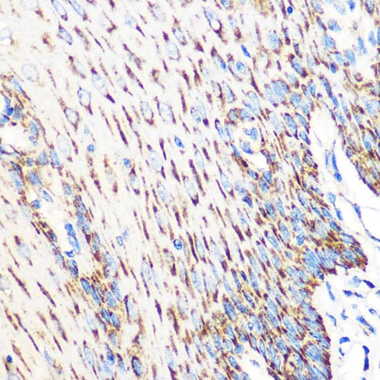 Immunohistochemistry OSR1 Antibody