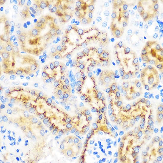 Immunohistochemistry: OSR1 Antibody [NBP3-35813] - Immunohistochemistry analysis of paraffin-embedded Mouse kidney using OSR1 Rabbit pAb at dilution of 1:100 (40x lens). Microwave antigen retrieval performed with 0.01M PBS Buffer (pH 7.2) prior to IHC staining.