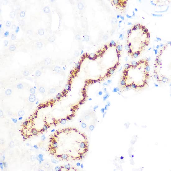 Immunohistochemistry: OSR1 Antibody [NBP3-35813] - Immunohistochemistry analysis of paraffin-embedded Rat kidney using OSR1 Rabbit pAb at dilution of 1:100 (40x lens). Microwave antigen retrieval performed with 0.01M PBS Buffer (pH 7.2) prior to IHC staining.