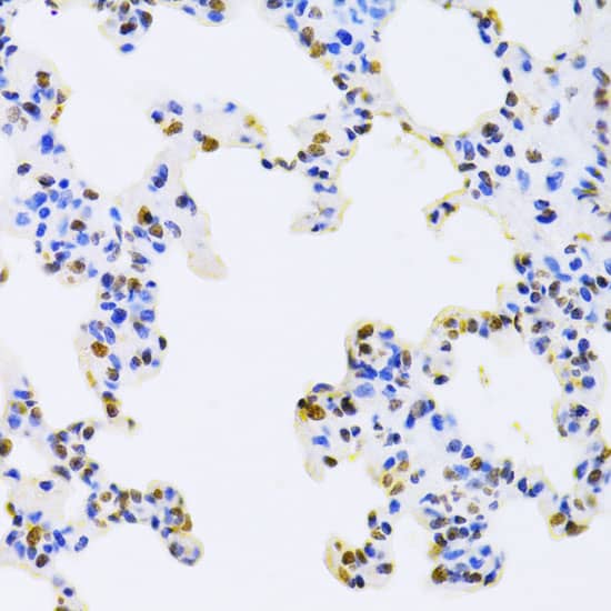 Immunohistochemistry: AUF1 Antibody [NBP3-35815] - Immunohistochemistry analysis of paraffin-embedded Rat lung using AUF1 Rabbit pAb at dilution of 1:100 (40x lens). Microwave antigen retrieval performed with 0.01M PBS Buffer (pH 7.2) prior to IHC staining.