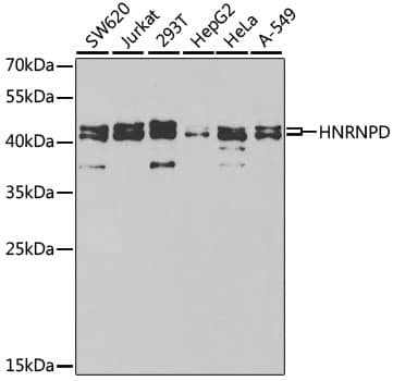 Western Blot: AUF1 Antibody [NBP3-35815] - Western blot analysis of various lysates using AUF1 Rabbit pAb at 1:1000 dilution.Secondary antibody: HRP-conjugated Goat anti-Rabbit IgG (H+L) at 1:10000 dilution.Lysates/proteins: 25ug per lane.Blocking buffer: 3% nonfat dry milk in TBST.Detection: ECL Basic Kit.Exposure time: 90s.