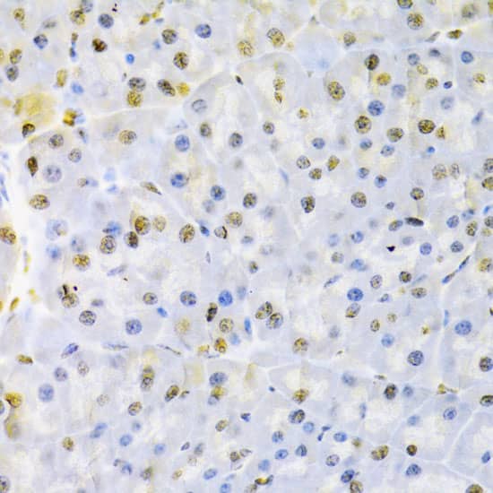 Immunohistochemistry: AUF1 Antibody [NBP3-35815] - Immunohistochemistry analysis of paraffin-embedded Mouse pancreas using AUF1 Rabbit pAb at dilution of 1:100 (40x lens). Microwave antigen retrieval performed with 0.01M PBS Buffer (pH 7.2) prior to IHC staining.