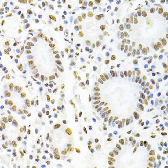 Immunohistochemistry: AUF1 Antibody [NBP3-35815] - Immunohistochemistry analysis of paraffin-embedded Human stomach using AUF1 Rabbit pAb at dilution of 1:100 (40x lens). Microwave antigen retrieval performed with 0.01M PBS Buffer (pH 7.2) prior to IHC staining.