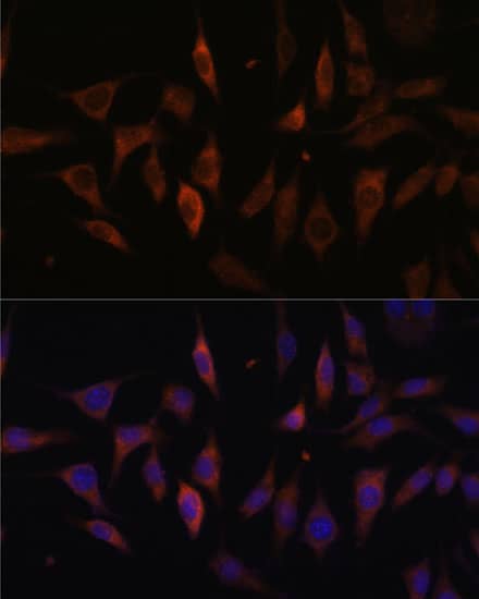 Immunocytochemistry/ Immunofluorescence: MT-ND1 Antibody [NBP3-35818] - Immunofluorescence analysis of L929 cells using MT-ND1 Rabbit pAb at dilution of 1:100. Secondary antibody: Cy3-conjugated Goat anti-Rabbit IgG (H+L) at 1:500 dilution. Blue: DAPI for nuclear staining.