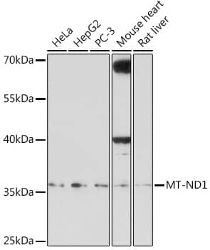 Western Blot: MT-ND1 Antibody [NBP3-35818] - Western blot analysis of various lysates using MT-ND1 Rabbit pAb at 1:1000 dilution.Secondary antibody: HRP-conjugated Goat anti-Rabbit IgG (H+L) at 1:10000 dilution.Lysates/proteins: 25ug per lane.Blocking buffer: 3% nonfat dry milk in TBST.Detection: ECL Enhanced Kit.Exposure time: 120s.