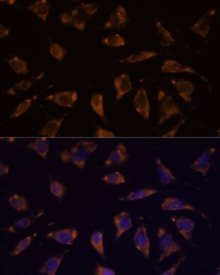 Immunocytochemistry/ Immunofluorescence: PTRF Antibody [NBP3-35822] - Immunofluorescence analysis of L929 cells using PTRF Rabbit pAb at dilution of 1:100. Secondary antibody: Cy3-conjugated Goat anti-Rabbit IgG (H+L) at 1:500 dilution. Blue: DAPI for nuclear staining.