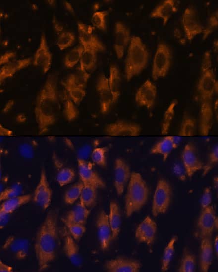 Immunocytochemistry/ Immunofluorescence: PTRF Antibody [NBP3-35822] - Immunofluorescence analysis of C6 cells using PTRF Rabbit pAb at dilution of 1:100. Secondary antibody: Cy3-conjugated Goat anti-Rabbit IgG (H+L) at 1:500 dilution. Blue: DAPI for nuclear staining.