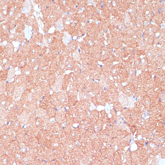 Immunohistochemistry: ARHGAP4 Antibody [NBP3-35825] - Immunohistochemistry analysis of paraffin-embedded Rat heart using ARHGAP4 Rabbit pAb at dilution of 1:100 (40x lens). Microwave antigen retrieval performed with 0.01M PBS Buffer (pH 7.2) prior to IHC staining.