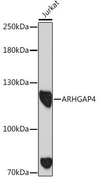 Western Blot: ARHGAP4 Antibody [NBP3-35825] - Western blot analysis of lysates from Jurkat cells, using ARHGAP4 Rabbit pAb at 1:1000 dilution.Secondary antibody: HRP-conjugated Goat anti-Rabbit IgG (H+L) at 1:10000 dilution.Lysates/proteins: 25ug per lane.Blocking buffer: 3% nonfat dry milk in TBST.Detection: ECL Basic Kit.Exposure time: 90s.