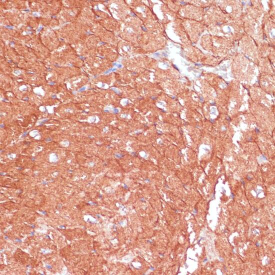 Immunohistochemistry: ARHGAP4 Antibody [NBP3-35825] - Immunohistochemistry analysis of paraffin-embedded Mouse heart using ARHGAP4 Rabbit pAb at dilution of 1:100 (40x lens). Microwave antigen retrieval performed with 0.01M PBS Buffer (pH 7.2) prior to IHC staining.