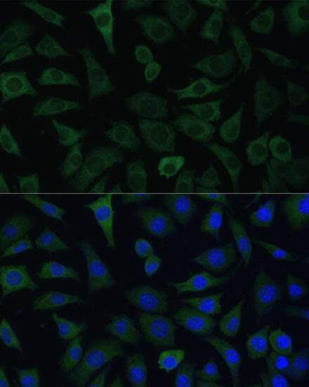 Immunocytochemistry/ Immunofluorescence: ARHGAP4 Antibody [NBP3-35825] - Immunofluorescence analysis of L929 cells using ARHGAP4 Rabbit pAb at dilution of 1:100. Secondary antibody: Cy3-conjugated Goat anti-Rabbit IgG (H+L) at 1:500 dilution. Blue: DAPI for nuclear staining.