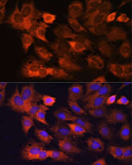 Immunocytochemistry/ Immunofluorescence: RPS8 Antibody [NBP3-35828] - Immunofluorescence analysis of C6 cells using RPS8 Rabbit pAb at dilution of 1:100. Blue: DAPI for nuclear staining.