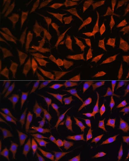 Immunocytochemistry/ Immunofluorescence: RPS8 Antibody [NBP3-35828] - Immunofluorescence analysis of L929 cells using RPS8 Rabbit pAb at dilution of 1:100. Blue: DAPI for nuclear staining.