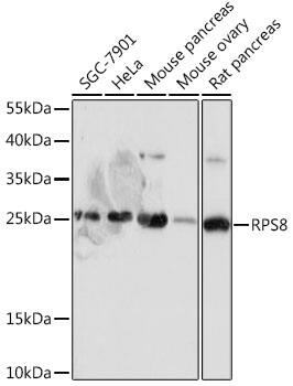 Western Blot: RPS8 Antibody [NBP3-35828] - Western blot analysis of various lysates using RPS8 Rabbit pAb at 1:1000 dilution.Secondary antibody: HRP-conjugated Goat anti-Rabbit IgG (H+L) at 1:10000 dilution.Lysates/proteins: 25ug per lane.Blocking buffer: 3% nonfat dry milk in TBST.Detection: ECL Basic Kit.Exposure time: 90s.