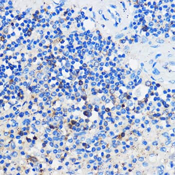 Immunohistochemistry: GPR109B/HM74 Antibody [NBP3-35830] - Immunohistochemistry analysis of paraffin-embedded Human spleen using GPR109B/HM74 Rabbit pAb at dilution of 1:100 (40x lens). Microwave antigen retrieval performed with 0.01M PBS Buffer (pH 7.2) prior to IHC staining.