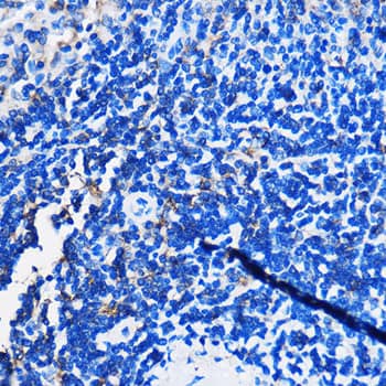 Immunohistochemistry: GPR109B/HM74 Antibody [NBP3-35830] - Immunohistochemistry analysis of paraffin-embedded Rat spleen using GPR109B/HM74 Rabbit pAb at dilution of 1:100 (40x lens). Microwave antigen retrieval performed with 0.01M PBS Buffer (pH 7.2) prior to IHC staining.