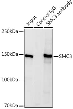 Immunoprecipitation: SMC3 Antibody [NBP3-35831] - Immunoprecipitation analysis of 600 ug extracts of Mouse spleen using 3 ug SMC3 antibody. Western blot was performed from the immunoprecipitate using SMC3 antibody at a dilution of 1:1000.