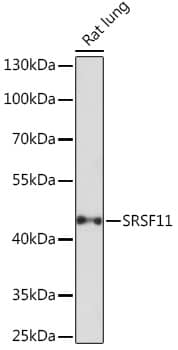 Western Blot: Splicing factor, arginine/serine-rich 11 Antibody [NBP3-35832] - Western blot analysis of lysates from Rat lung, using Splicing factor, arginine/serine-rich 11 Rabbit pAb at 1:1000 dilution.Secondary antibody: HRP-conjugated Goat anti-Rabbit IgG (H+L) at 1:10000 dilution.Lysates/proteins: 25ug per lane.Blocking buffer: 3% nonfat dry milk in TBST.Detection: ECL Basic Kit.Exposure time: 180s.