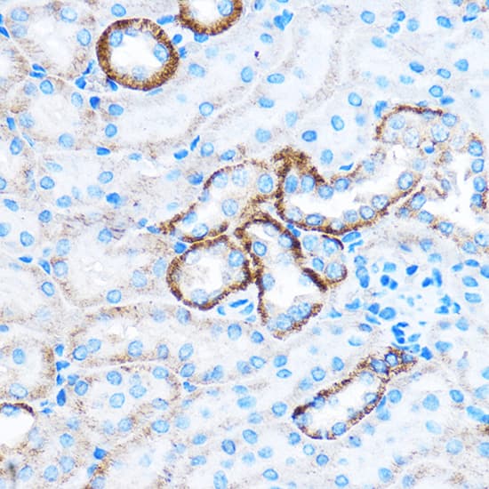 Immunohistochemistry CABP1 Antibody