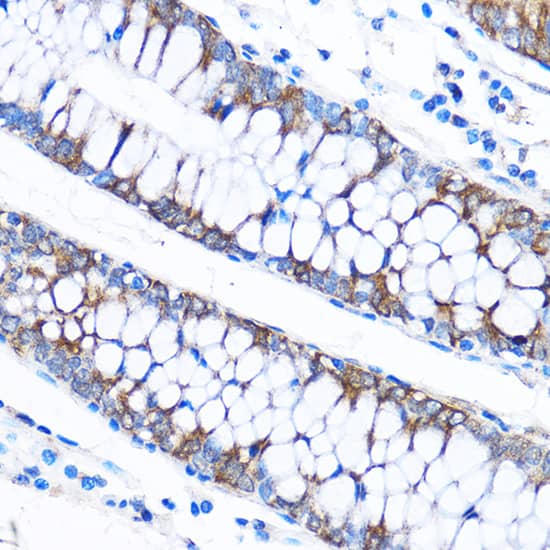 Immunohistochemistry CABP1 Antibody