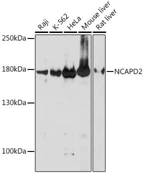 Western Blot: CNAP1 Antibody [NBP3-35835] - Western blot analysis of various lysates using CNAP1 Rabbit pAb at 1:1000 dilution.Secondary antibody: HRP-conjugated Goat anti-Rabbit IgG (H+L) at 1:10000 dilution.Lysates/proteins: 25ug per lane.Blocking buffer: 3% nonfat dry milk in TBST.Detection: ECL Basic Kit.Exposure time: 180s.