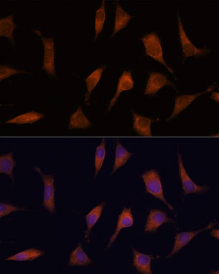 Immunocytochemistry/ Immunofluorescence: CNAP1 Antibody [NBP3-35835] - Immunofluorescence analysis of L929 cells using CNAP1 Rabbit pAb at dilution of 1:100. Blue: DAPI for nuclear staining.