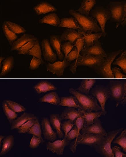 Immunocytochemistry/ Immunofluorescence: CNAP1 Antibody [NBP3-35835] - Immunofluorescence analysis of U2OS cells using CNAP1 Rabbit pAb at dilution of 1:100. Blue: DAPI for nuclear staining.