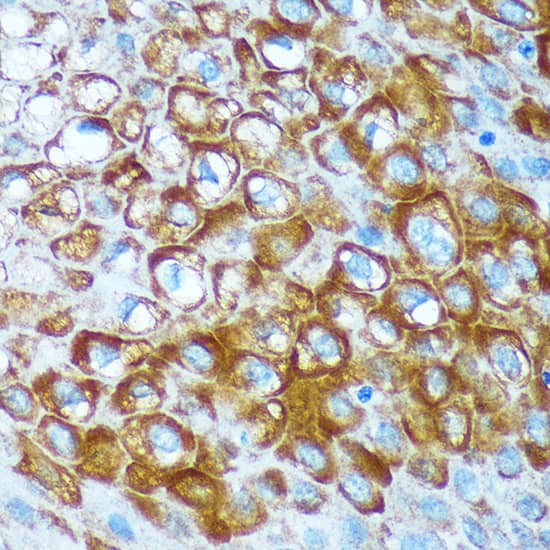 Immunohistochemistry RCE1 Antibody