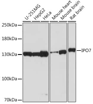 Western Blot: Importin-7 Antibody [NBP3-35837] - Western blot analysis of various lysates using Importin-7 Rabbit pAb at 1:2000 dilution.Secondary antibody: HRP-conjugated Goat anti-Rabbit IgG (H+L) at 1:10000 dilution.Lysates/proteins: 25ug per lane.Blocking buffer: 3% nonfat dry milk in TBST.Detection: ECL Basic Kit.Exposure time: 30s.