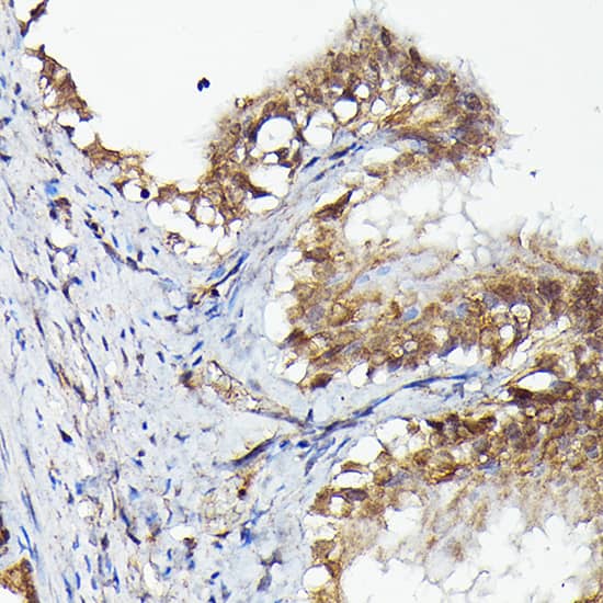 Immunohistochemistry: MNK1 Antibody [NBP3-35840] - Immunohistochemistry analysis of paraffin-embedded Rat fallopian tube using MNK1 Rabbit pAb at dilution of 1:50 (40x lens). High pressure antigen retrieval performed with 0.01M Citrate Bufferr (pH 6.0) prior to IHC staining.