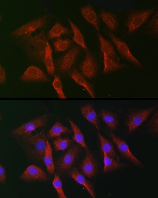 Immunocytochemistry/ Immunofluorescence: MNK1 Antibody [NBP3-35840] - Immunofluorescence analysis of NIH-3T3 cells using MNK1 Rabbit pAb at dilution of 1:50 (40x lens). Secondary antibody: Cy3-conjugated Goat anti-Rabbit IgG (H+L) at 1:500 dilution. Blue: DAPI for nuclear staining.