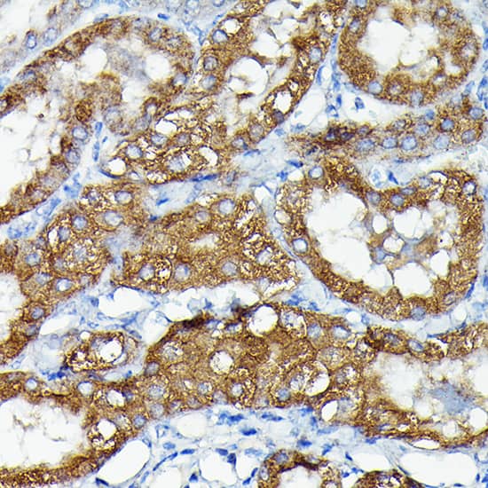 Immunohistochemistry: MNK1 Antibody [NBP3-35840] - Immunohistochemistry analysis of paraffin-embedded Mouse kidney using MNK1 Rabbit pAb at dilution of 1:50 (40x lens). High pressure antigen retrieval performed with 0.01M Citrate Bufferr (pH 6.0) prior to IHC staining.