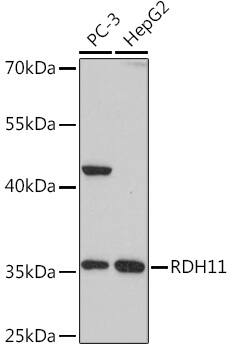 Western Blot RDH11 Antibody