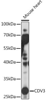 Western Blot: CDV3 Antibody [NBP3-35853] - Western blot analysis of lysates from Mouse heart, using CDV3 Rabbit pAb at 1:1000 dilution.Secondary antibody: HRP-conjugated Goat anti-Rabbit IgG (H+L) at 1:10000 dilution.Lysates/proteins: 25ug per lane.Blocking buffer: 3% nonfat dry milk in TBST.Detection: ECL Basic Kit.Exposure time: 10s.