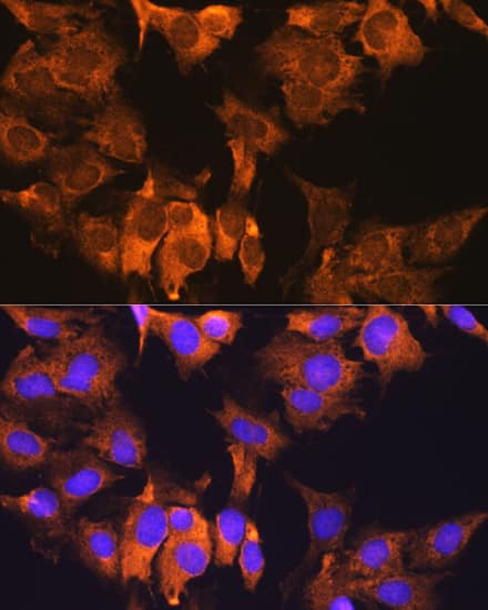 Immunocytochemistry/ Immunofluorescence: CDV3 Antibody [NBP3-35853] - Immunofluorescence analysis of C6 cells using CDV3 Rabbit pAb at dilution of 1:100. Secondary antibody: Cy3-conjugated Goat anti-Rabbit IgG (H+L) at 1:500 dilution. Blue: DAPI for nuclear staining.