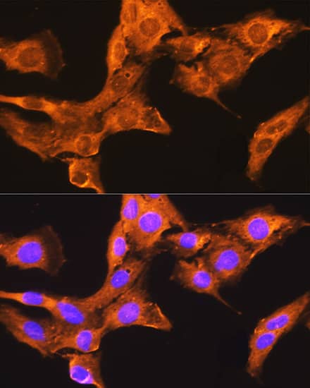 Immunocytochemistry/ Immunofluorescence: CDV3 Antibody [NBP3-35853] - Immunofluorescence analysis of L929 cells using CDV3 Rabbit pAb at dilution of 1:100. Secondary antibody: Cy3-conjugated Goat anti-Rabbit IgG (H+L) at 1:500 dilution. Blue: DAPI for nuclear staining.