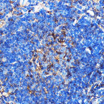 Immunohistochemistry: SERINC1 Antibody [NBP3-35855] - Immunohistochemistry analysis of paraffin-embedded Mouse spleen using SERINC1 Rabbit pAb at dilution of 1:100 (40x lens). Microwave antigen retrieval performed with 0.01M PBS Buffer (pH 7.2) prior to IHC staining.