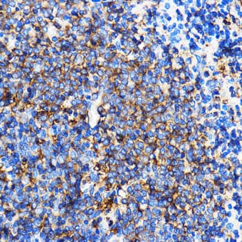 Immunohistochemistry SERINC1 Antibody