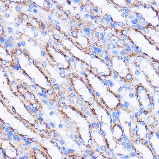 Immunohistochemistry: MIER1 Antibody [NBP3-35857] - Immunohistochemistry analysis of paraffin-embedded Mouse kidney using MIER1 Rabbit pAb at dilution of 1:100 (40x lens). Microwave antigen retrieval performed with 0.01M PBS Buffer (pH 7.2) prior to IHC staining.