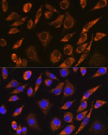 Immunocytochemistry/ Immunofluorescence: BRUNOL5 Antibody [NBP3-35858] - Immunofluorescence analysis of L929 cells using BRUNOL5 Rabbit pAb at dilution of 1:100. Secondary antibody: Cy3-conjugated Goat anti-Rabbit IgG (H+L) at 1:500 dilution. Blue: DAPI for nuclear staining.