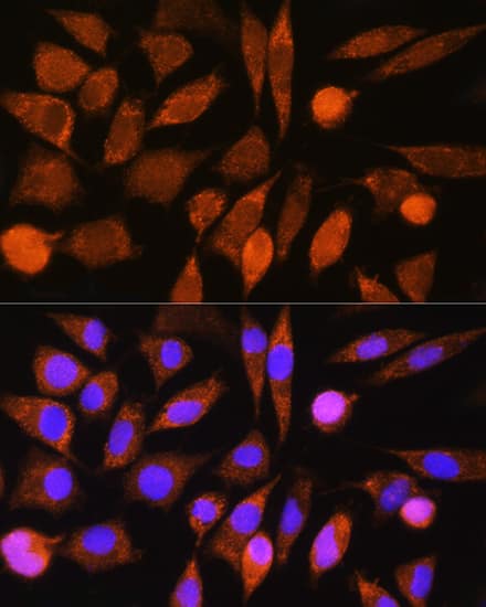 Immunocytochemistry/ Immunofluorescence CHCHD7 Antibody