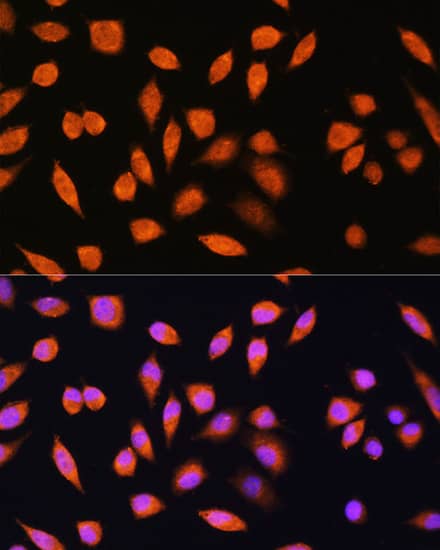 Immunocytochemistry/ Immunofluorescence: PNPO Antibody [NBP3-35861] - Immunofluorescence analysis of L929 cells using PNPO Rabbit pAb at dilution of 1:100. Blue: DAPI for nuclear staining.