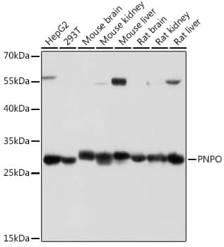 Western Blot: PNPO Antibody [NBP3-35861] - Western blot analysis of various lysates using PNPO Rabbit pAb at 1:1000 dilution.Secondary antibody: HRP-conjugated Goat anti-Rabbit IgG (H+L) at 1:10000 dilution.Lysates/proteins: 25ug per lane.Blocking buffer: 3% nonfat dry milk in TBST.Detection: ECL Basic Kit.Exposure time: 1s.